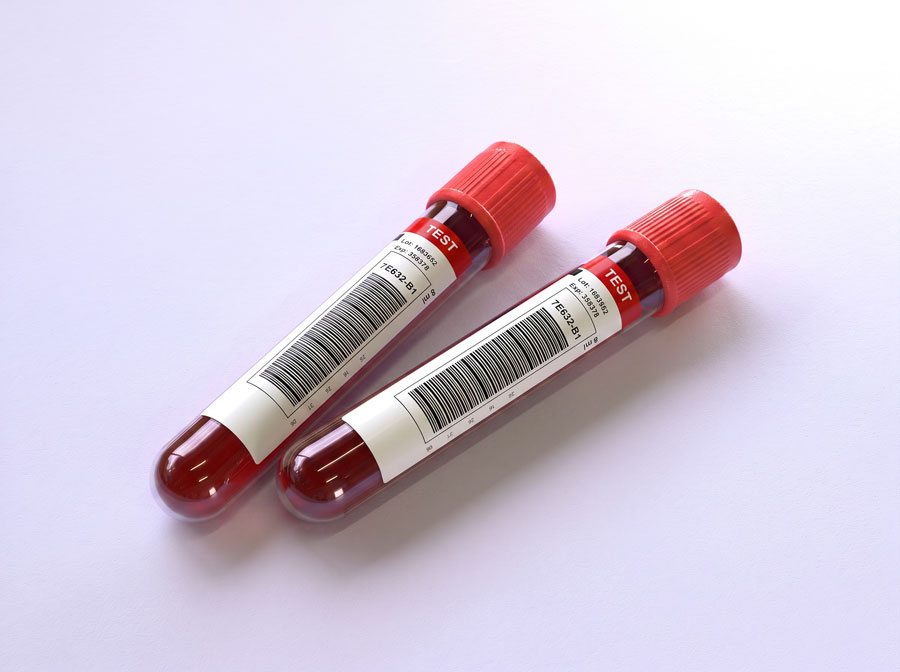 Lab packages